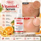 Hiba's Collection Vitamin C Face Serum 30ml